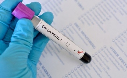 На Донеччині за добу понад 500 нових випадків коронавірусу, в Україні - 10 тисяч