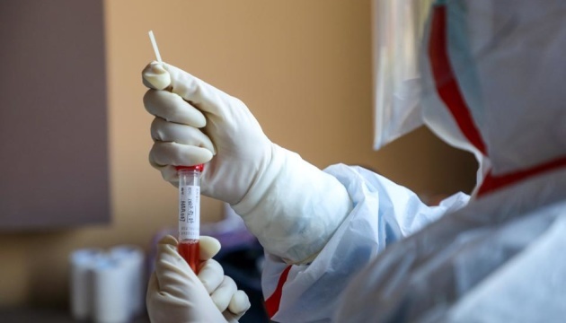 Коронавірус відступає? В Україні різкий спад захворюваності – 6 506 заражень за добу
