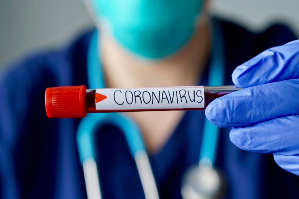 На Донеччині від коронавірусу померло двоє людей